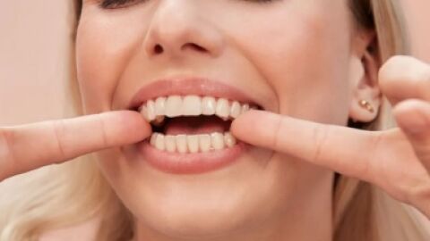 Alinhadores invisíveis revolucionam tratamento de dentes na cidade