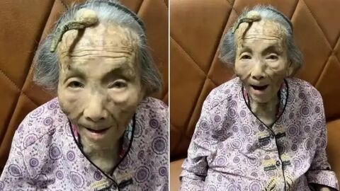 Aos 107 anos, idosa surge com chifre de 10 cm e vira fenômeno na China