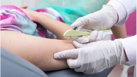 A partir de hoje, implante contraceptivo deve ser coberto por planos de saúde