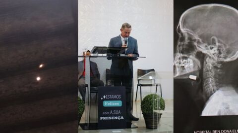 Pastor é atingido por bala perdida no rosto enquanto dormia