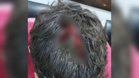 Jovem sobrevive, mas fica em estado grave após levar 5 tiros em praça de MS