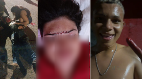 Vídeos: Gangue cerca e espanca rapaz autista em Campo Grande