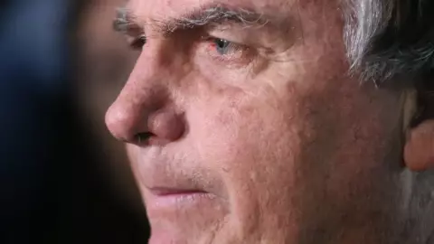 Após queda em cela, Moraes autoriza 1ª saidinha de Bolsonaro 