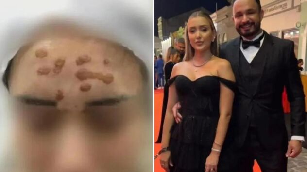 Casal de influenciadores é indiciado por mutilar clientes em clínica