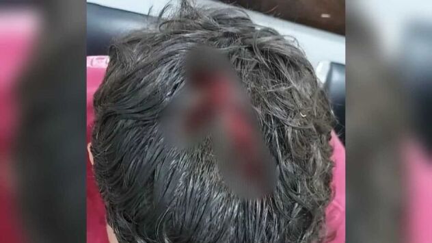 Jovem sobrevive, mas fica em estado grave após levar 5 tiros em praça de MS