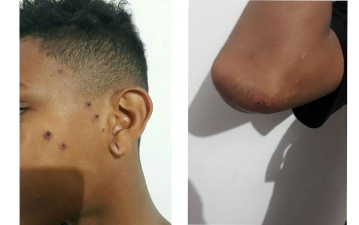 Reincidente em agressões contra adolescentes negros, em 2018, menino de 16 anos já levou tiros de "airsoft" no Pão de Açucar