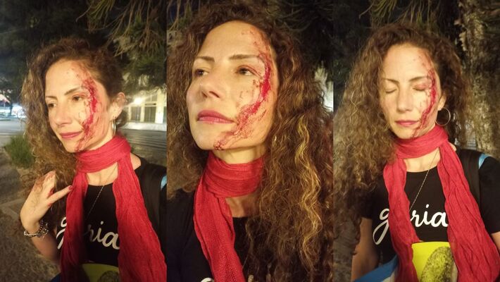 Ela foi agredida por desconhecido na rua. Foto: Redes
