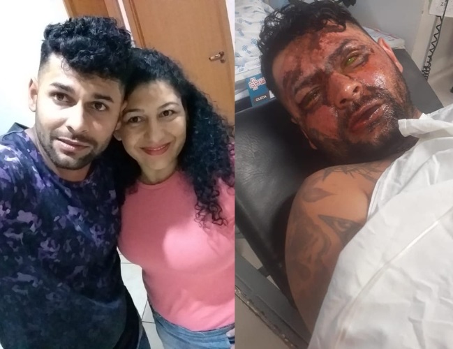 Sônia não aceitava fim do relacionamento e atacou o ex-marido jogando no rosto dele um líquido corrosívo. Foto: Acervo pessoal | TeatrineTV 
