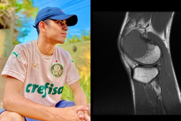 Thyago e foto da ressonância que mostra o tumor. (Foto: Arquivo Pessoal)