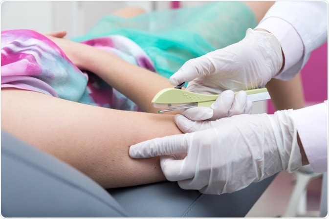 Na rede privada, Implanon custa até R$ 4 mil. 