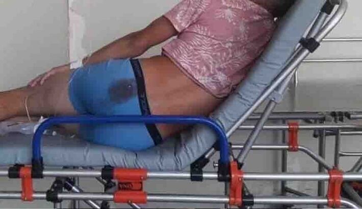 Homem foi baleado na nádega