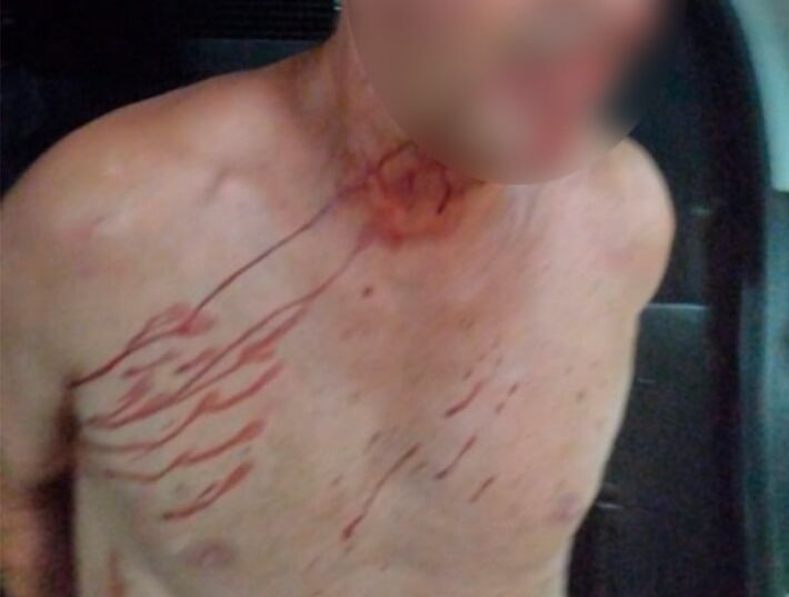 Homem foi agredido a pedradas pela população revoltada