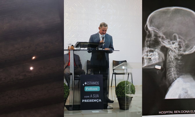 O pastor Jorge passou por cirurgia em hospital de Sidrolândia para a retirada do projétil. Fotos: Babalizando MS