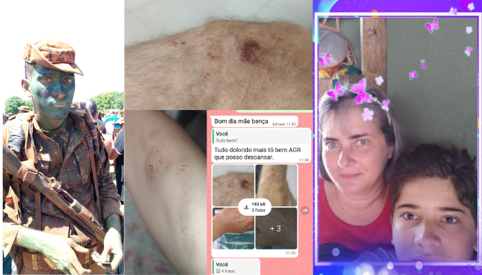 Mãe revela violências físicas sofridas pelo filho nas dependências do CMO. Foto: Reproduções