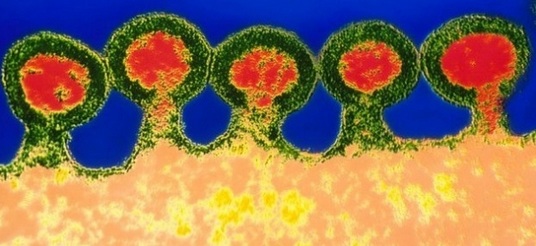 Imagem mostra o vírus HIV ampliado em microscópio