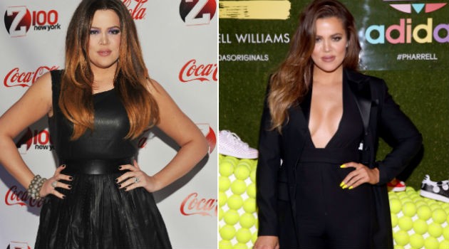 Antes e depois da Khloé Kardashian/GETTY IMAGES
