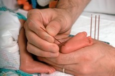 Teste do Pezinho, feito entre o 3º e 5º dia após o nascimento, detecta a doença