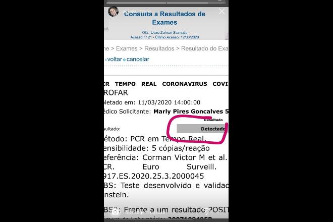 Universitário publicou em sua conta do Instagram o resultado do exame que fez no hospital Albert Einstein em São Paulo