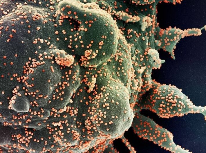 Ilustração de célula humana sendo atacada pelo novo coronavírus