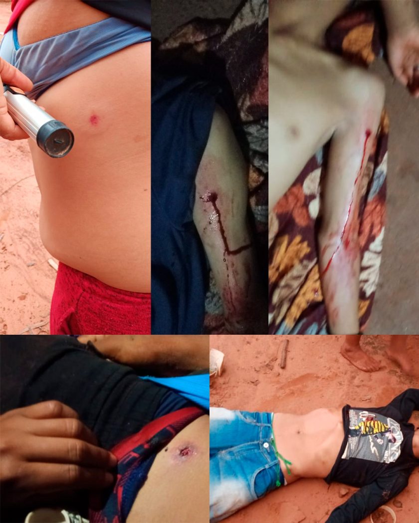 Mosaico de imagens mostra todos feridos e o corpo de Vicente após ataque de pistoleiros à retomada de Pyelito Kue. Fotos: Comunidade de Pyelito Kue
